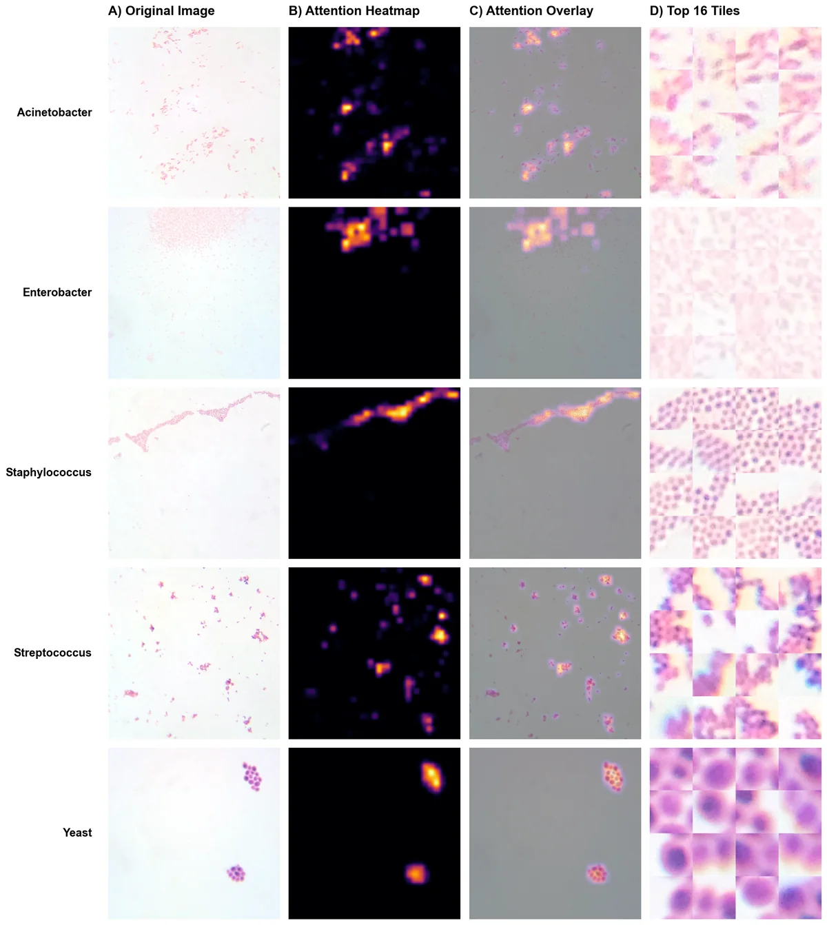 A four-column grid repeated for five classes — Acinetobacter, Enterobacter, Staphylococcus, Streptococcus and Yeast. Column A is the original Gram-stained micrograph, pink for Gram-negative rods and purple for Gram-positive cocci. Column B is the model's attention heatmap on black, where bright inferno-coloured peaks mark the tiles the model weighted most. Column C overlays that heatmap on the micrograph, showing the peaks landing on the stained organisms rather than on empty background. Column D shows the sixteen highest-attention tiles, each containing visible cells of the expected morphology.